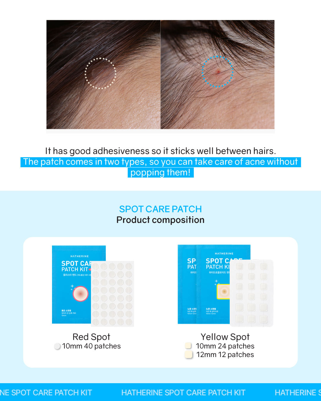 Hatherine Spot Care Patch Kit (76 patches)
