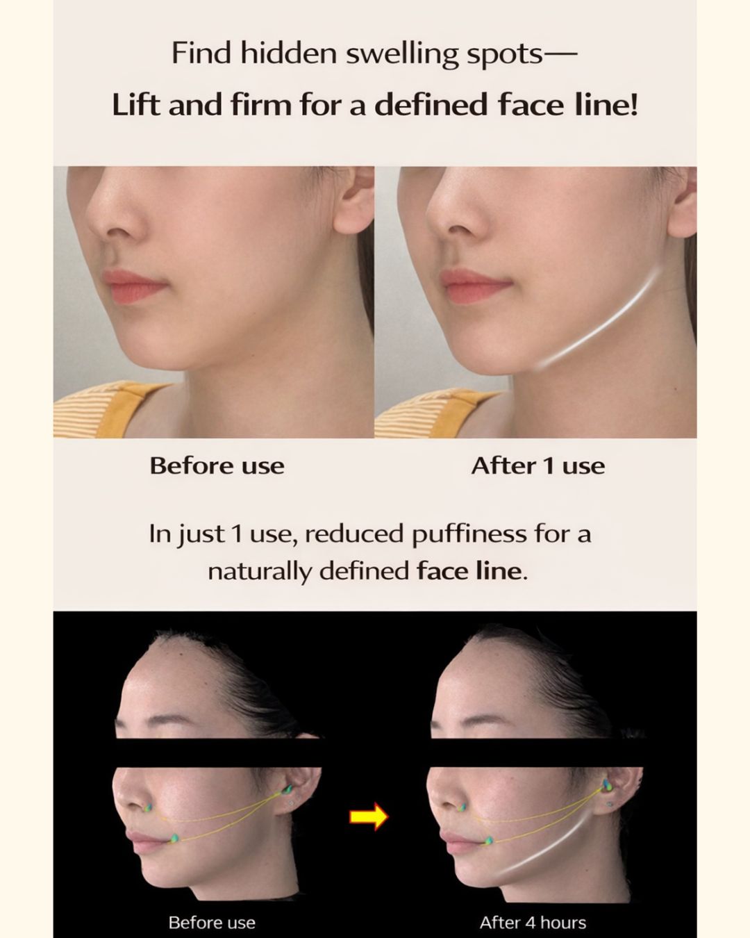 [PROMO] Returnity Ear V2 Acupressure Patch (Crystal/Pearl/Silver)
