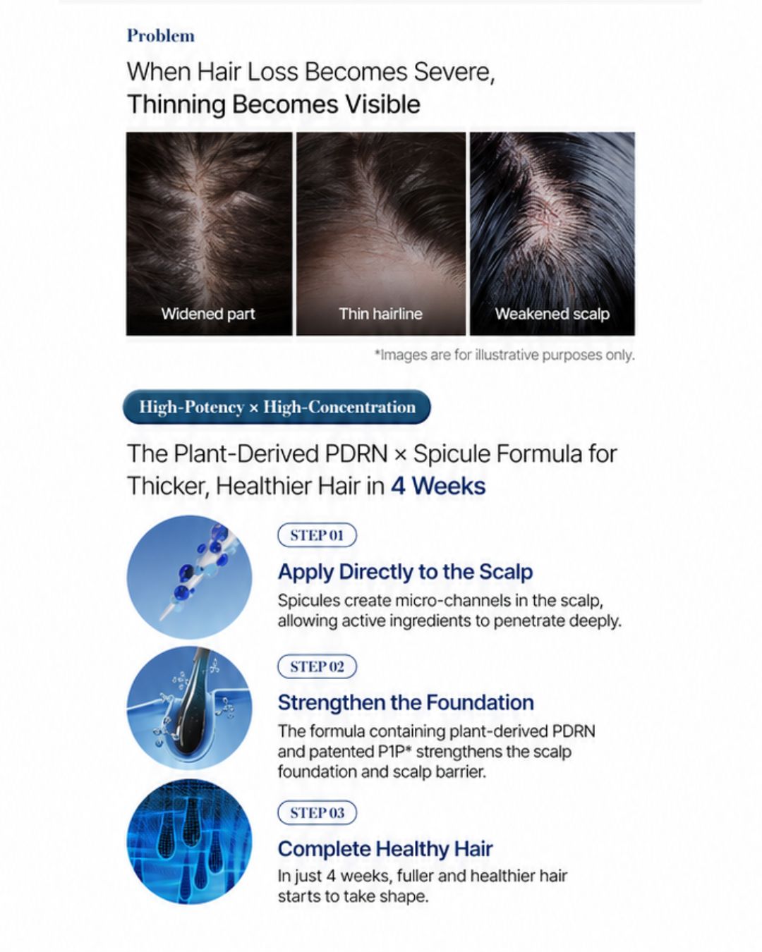 [PREORDER] Phytopecia PDRN Spicule 10000 Scalp Ampoule (15ml) (Dispatch Dates: 13-17 July)